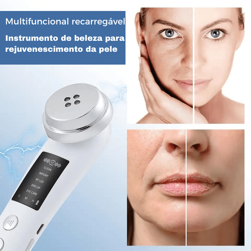 Massageador facial 5 em 1 - Truly Shop 